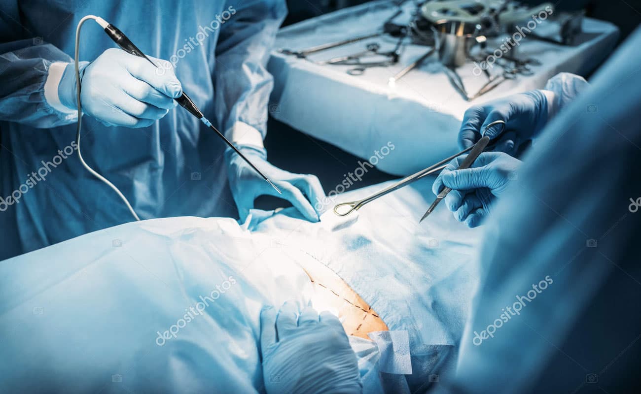 general-surgery